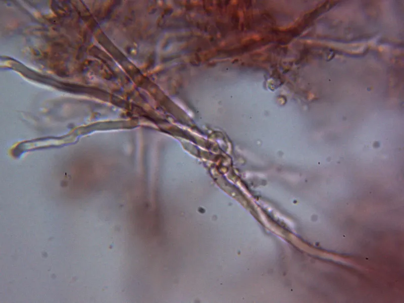 Brunneoporus hyalinus 10 - Hifa generativa fibulada